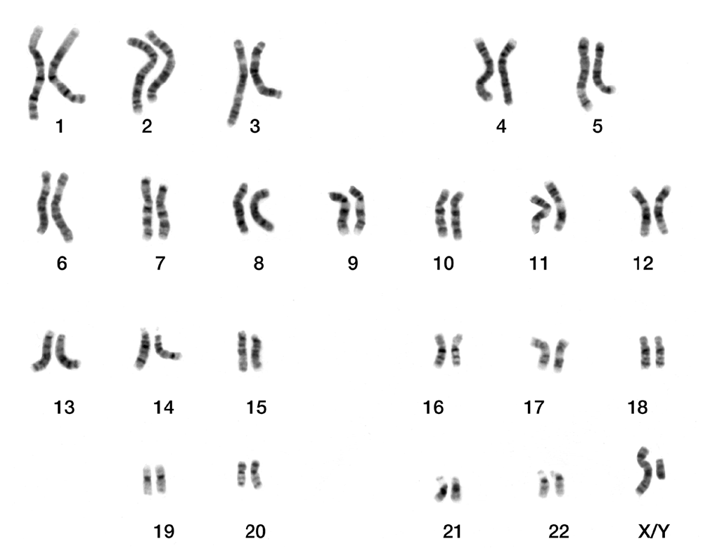 A regular set of chromosomes (Male). Wikimedia Commons