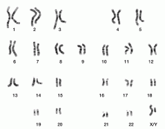 Normal Chromosomes (Male)